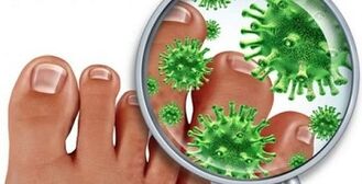 How to Treat a Fungal Infection on Fingers