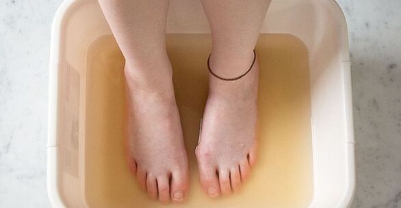 iodine bath for the treatment of nail fungus