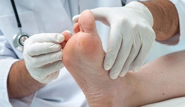 treatment and diagnosis of fungi by doctors