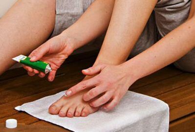 applying ointment to treat toenail fungus